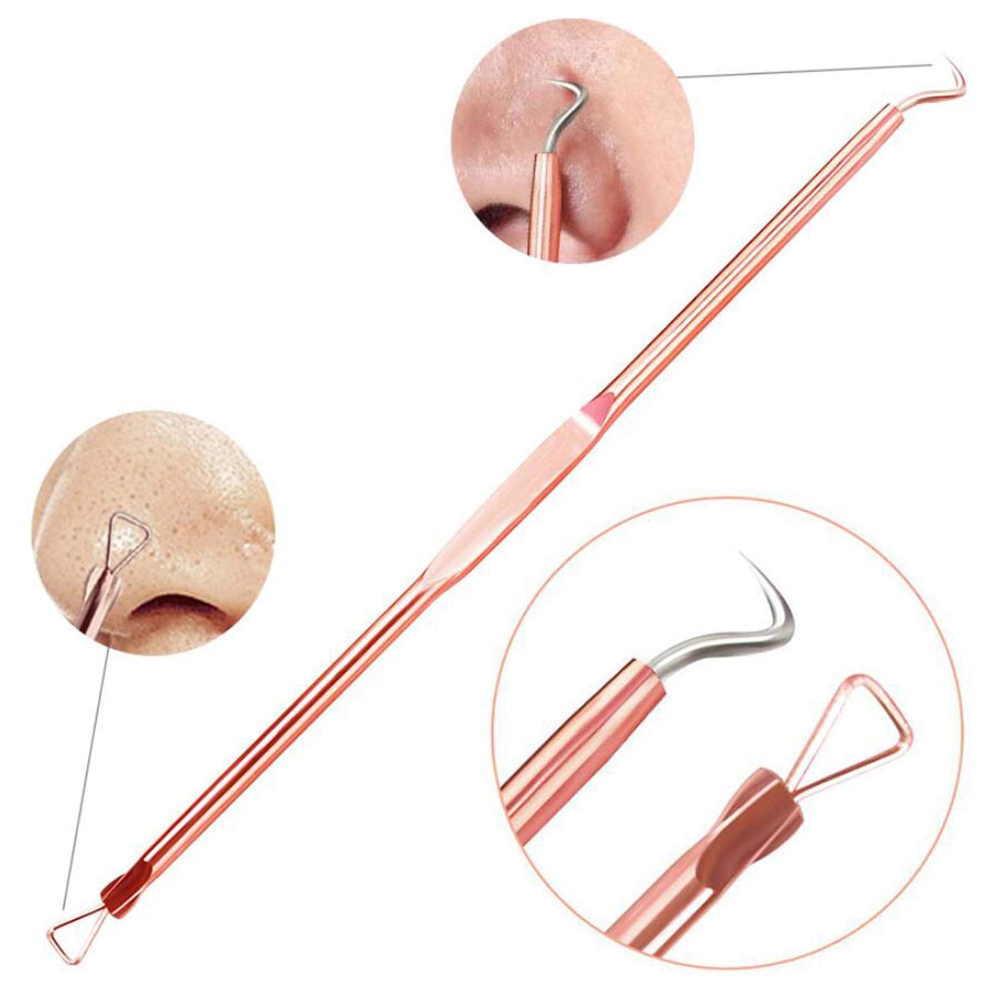 4-Piece Rose Gold Blackhead & Pimple Extractor Tool Set with Case – Acne & Comedone Removal Kit