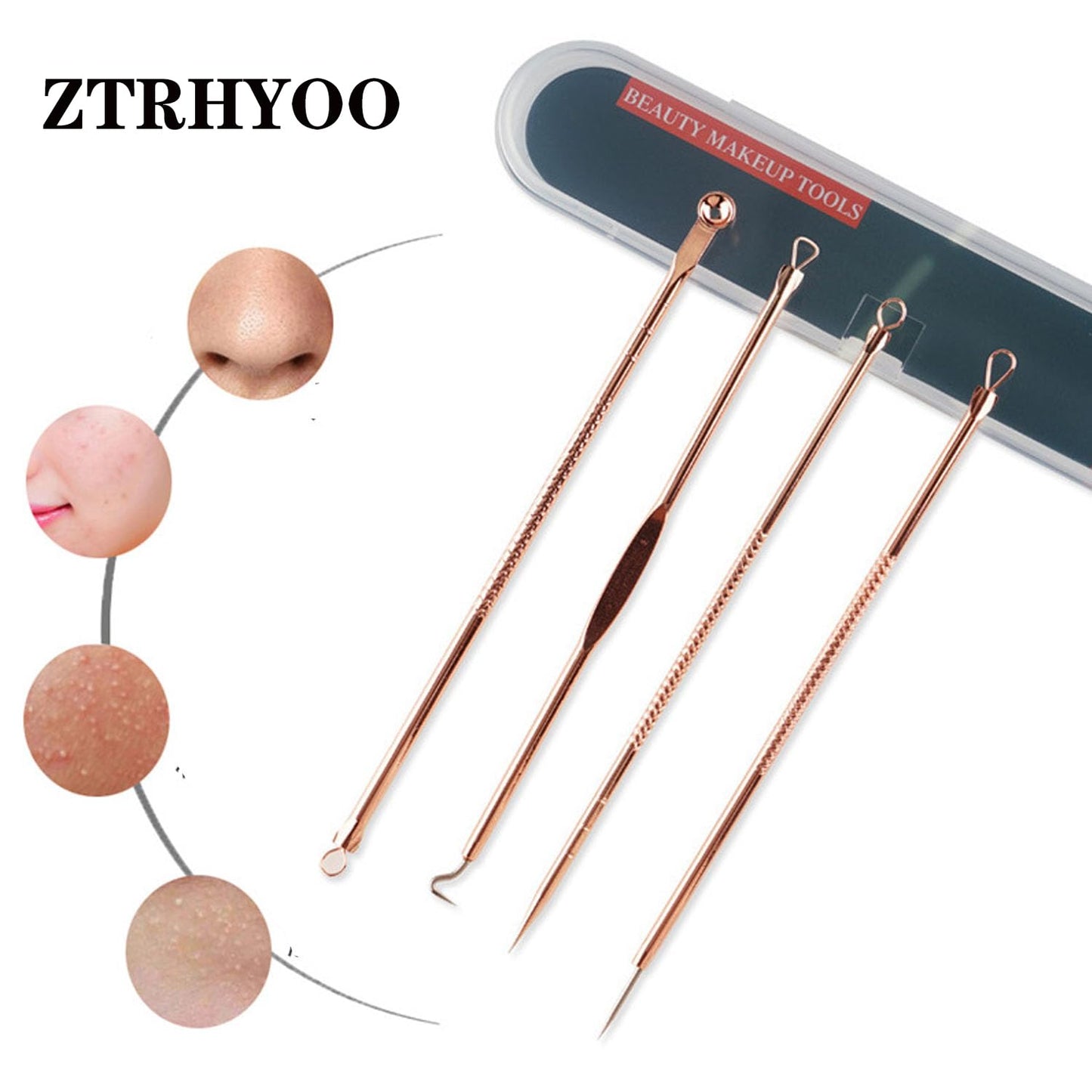 4-Piece Rose Gold Blackhead & Pimple Extractor Tool Set with Case – Acne & Comedone Removal Kit