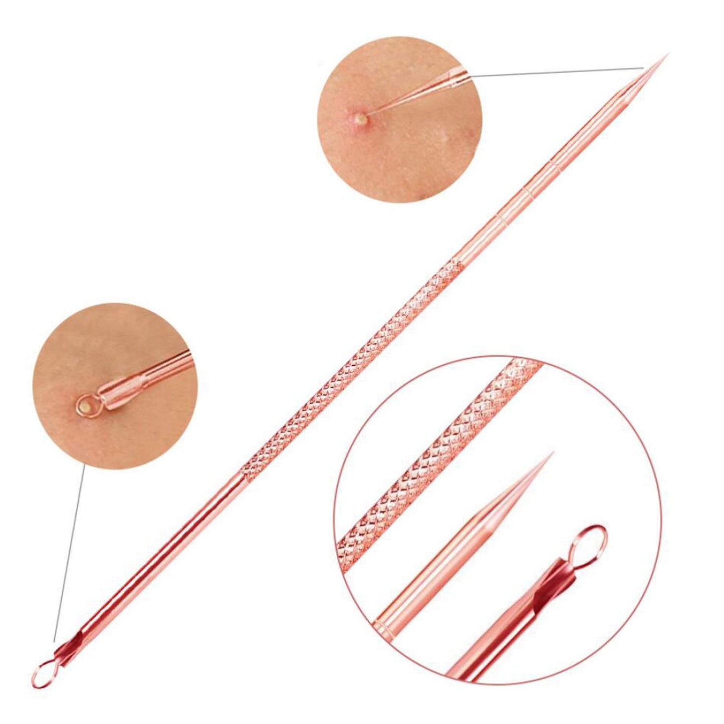 4-Piece Rose Gold Blackhead & Pimple Extractor Tool Set with Case – Acne & Comedone Removal Kit