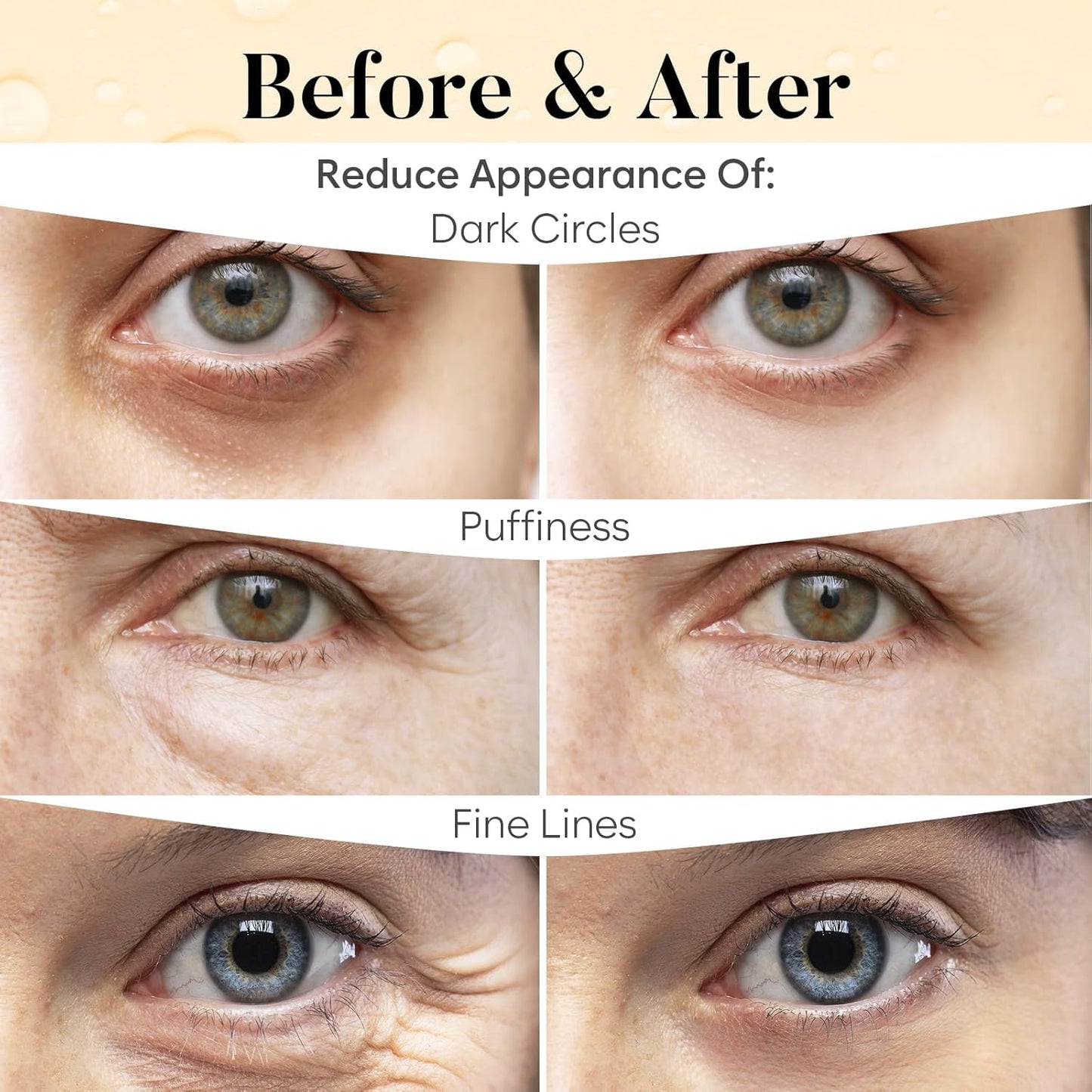 Vitamin C & Caffeine Under Eye Patches – 30 Pairs for Dark Circles & Puffiness